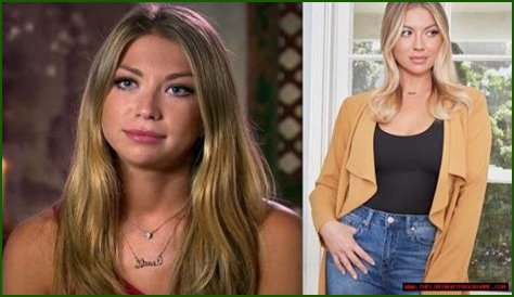 Stassi Schroeder Shocking Weight Loss: Did She Took Ozempic?